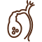 Gallbladder Surgery