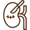 Kidney Transplant Anesthesia