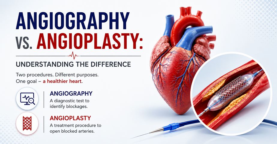 Angiography vs. Angioplasty_ Understanding the Difference